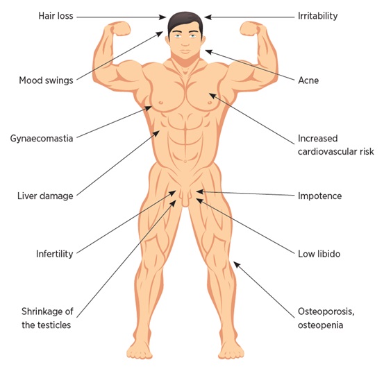 Side-Effects of Testosterone Cypionate